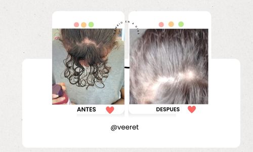 5.jpg__PID:b329e676-4924-42f5-95c7-ece753bda192